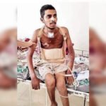 Falling from overcrowded delayed train, Titwala resident almost on death bed begins to walk again | Mumbai News